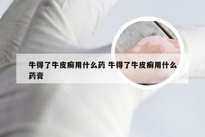 牛得了牛皮癣用什么药 牛得了牛皮癣用什么药膏