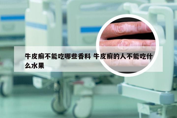 牛皮癣不能吃哪些香料 牛皮癣的人不能吃什么水果