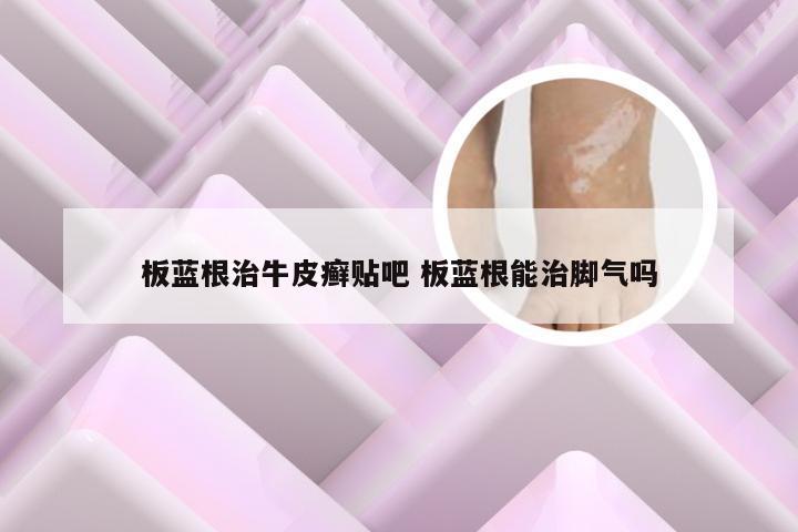 板蓝根治牛皮癣贴吧 板蓝根能治脚气吗