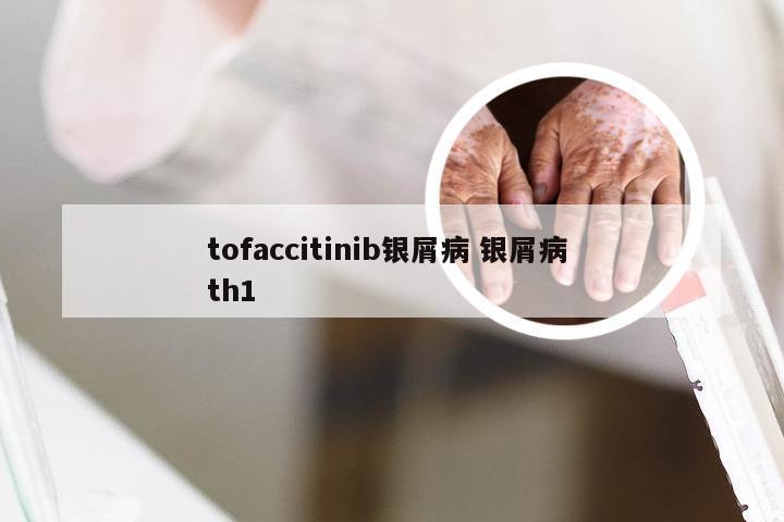 tofaccitinib银屑病 银屑病 th1