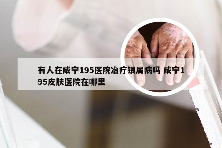 有人在咸宁195医院冶疗银屑病吗 咸宁195皮肤医院在哪里