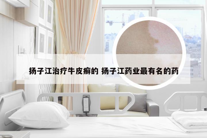 扬子江治疗牛皮癣的 扬子江药业最有名的药