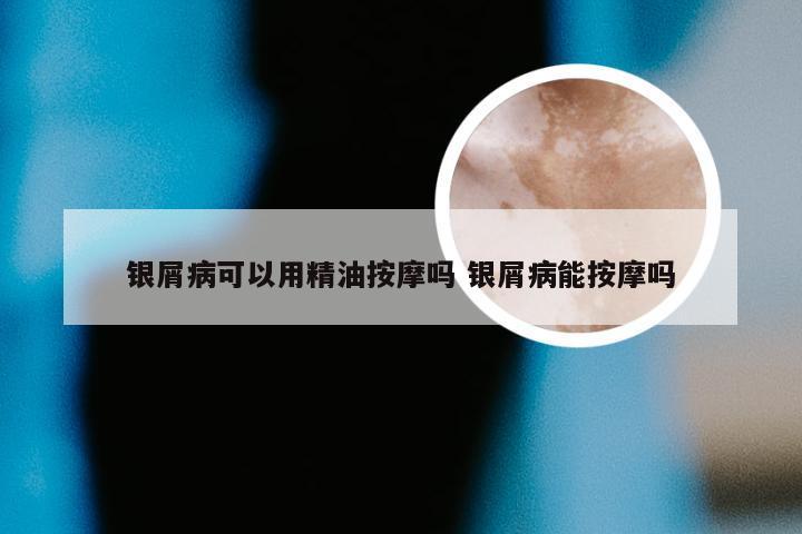 银屑病可以用精油按摩吗 银屑病能按摩吗