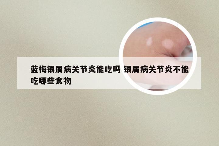 蓝梅银屑病关节炎能吃吗 银屑病关节炎不能吃哪些食物