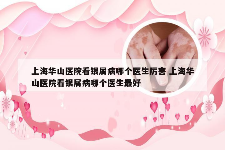 上海华山医院看银屑病哪个医生厉害 上海华山医院看银屑病哪个医生最好