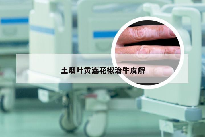 土烟叶黄连花椒治牛皮癣