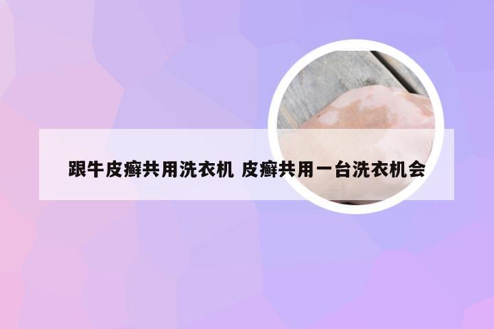跟牛皮癣共用洗衣机 皮癣共用一台洗衣机会