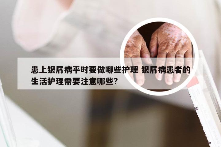 患上银屑病平时要做哪些护理 银屑病患者的生活护理需要注意哪些?