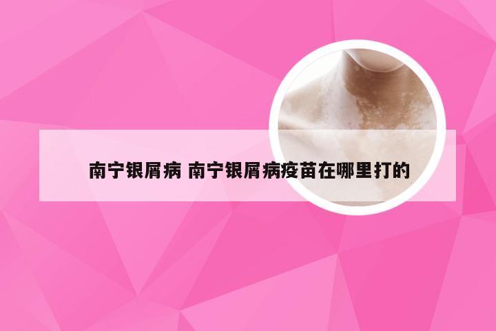 南宁银屑病 南宁银屑病疫苗在哪里打的