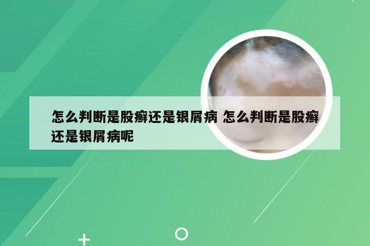 怎么判断是股癣还是银屑病 怎么判断是股癣还是银屑病呢