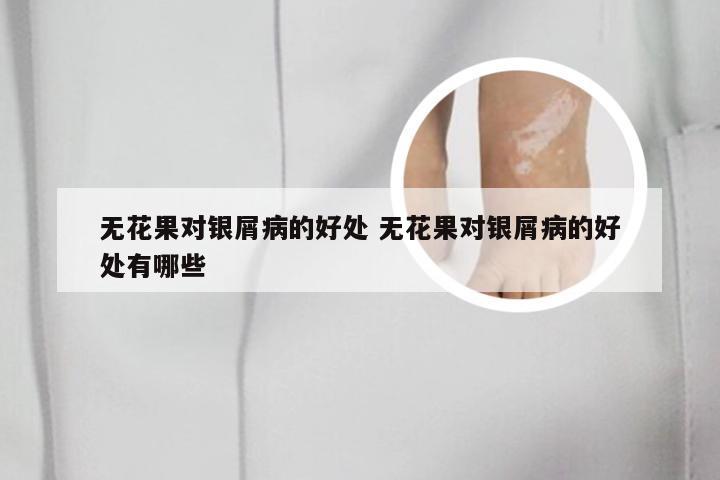 无花果对银屑病的好处 无花果对银屑病的好处有哪些