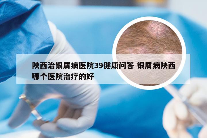 陕西治银屑病医院39健康问答 银屑病陕西哪个医院治疗的好