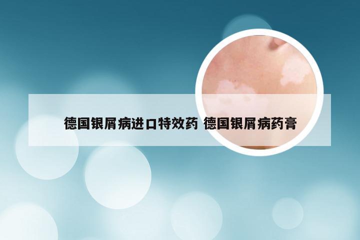 德国银屑病进口特效药 德国银屑病药膏