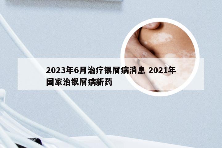 2023年6月治疗银屑病消息 2021年国家治银屑病新药