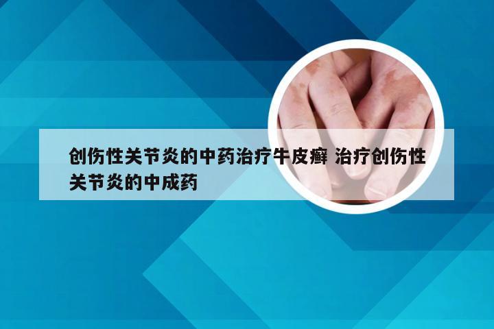创伤性关节炎的中药治疗牛皮癣 治疗创伤性关节炎的中成药