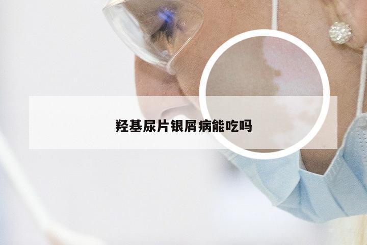 羟基尿片银屑病能吃吗