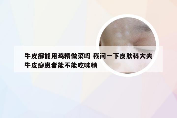牛皮癣能用鸡精做菜吗 我问一下皮肤科大夫牛皮癣患者能不能吃味精