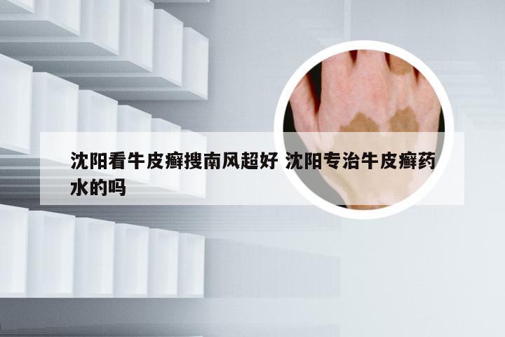 沈阳看牛皮癣搜南风超好 沈阳专治牛皮癣药水的吗