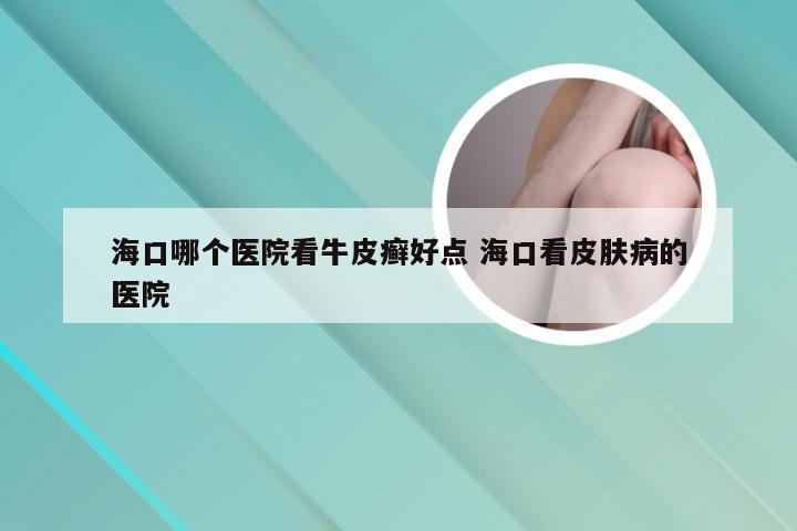 海口哪个医院看牛皮癣好点 海口看皮肤病的医院