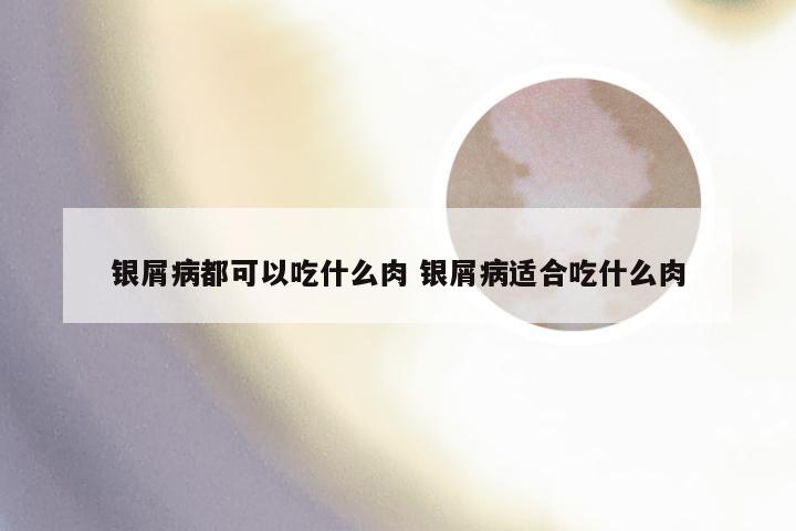 银屑病都可以吃什么肉 银屑病适合吃什么肉