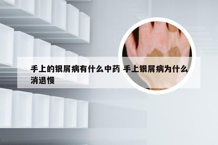 手上的银屑病有什么中药 手上银屑病为什么消退慢