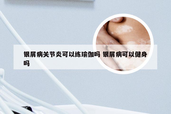 银屑病关节炎可以练瑜伽吗 银屑病可以健身吗