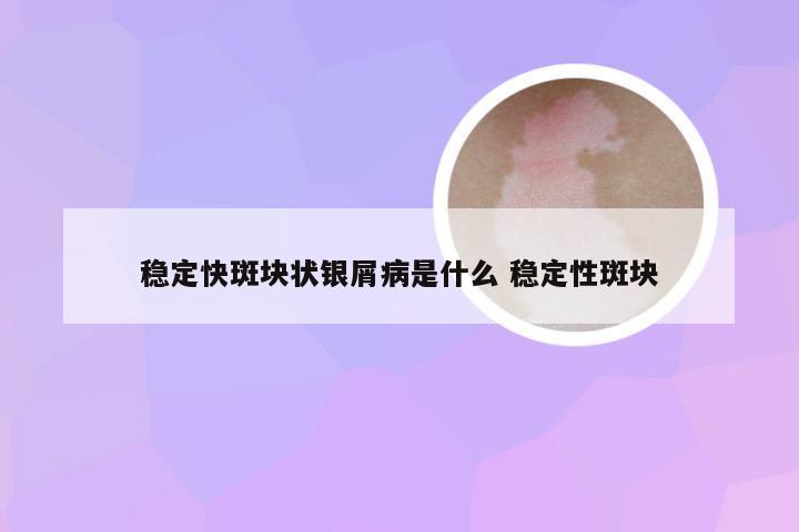 稳定快斑块状银屑病是什么 稳定性斑块