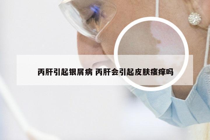 丙肝引起银屑病 丙肝会引起皮肤瘙痒吗