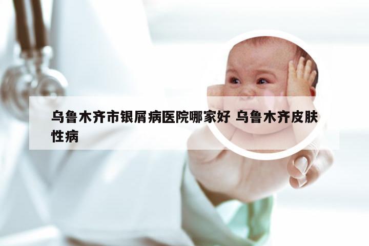乌鲁木齐市银屑病医院哪家好 乌鲁木齐皮肤性病