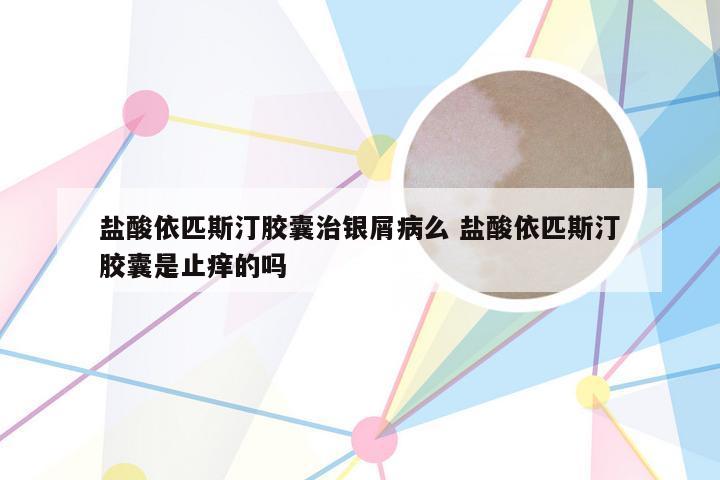 盐酸依匹斯汀胶囊治银屑病么 盐酸依匹斯汀胶囊是止痒的吗