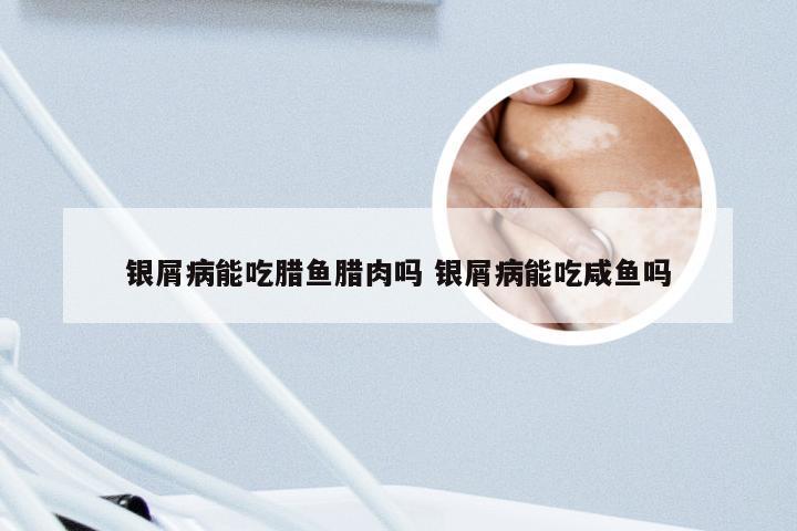 银屑病能吃腊鱼腊肉吗 银屑病能吃咸鱼吗