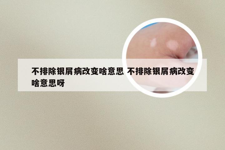 不排除银屑病改变啥意思 不排除银屑病改变啥意思呀