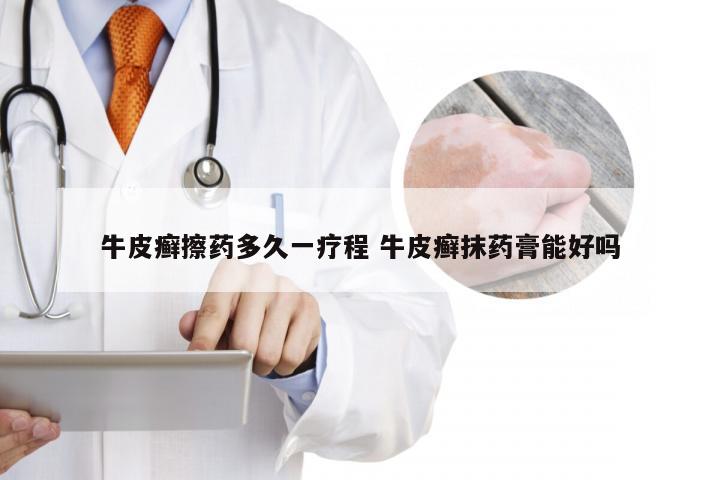 牛皮癣擦药多久一疗程 牛皮癣抹药膏能好吗