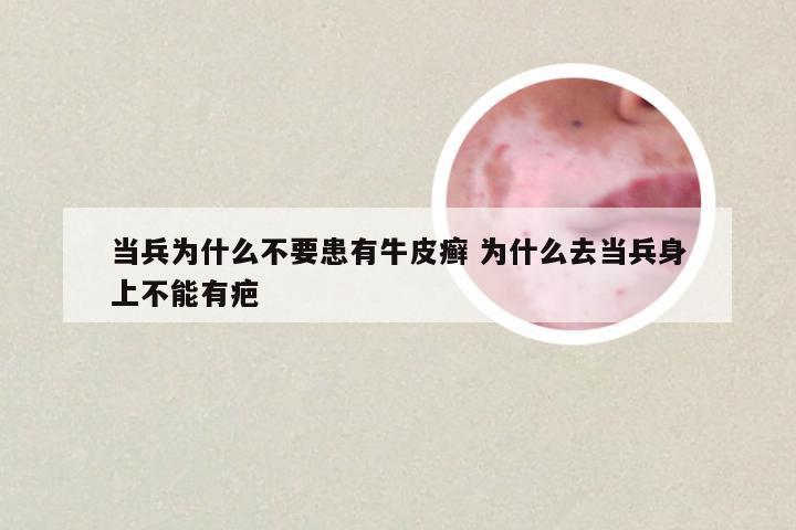 当兵为什么不要患有牛皮癣 为什么去当兵身上不能有疤