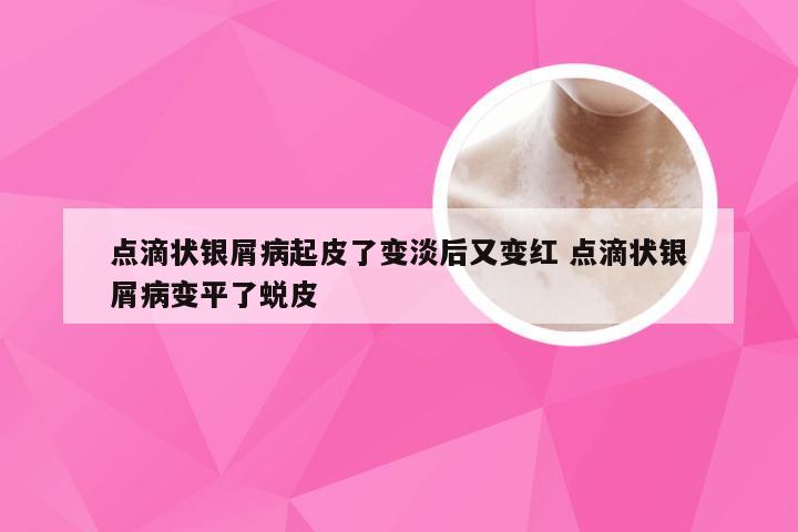点滴状银屑病起皮了变淡后又变红 点滴状银屑病变平了蜕皮