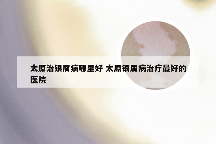 太原治银屑病哪里好 太原银屑病治疗最好的医院