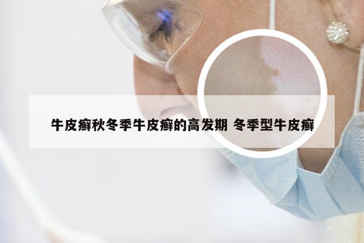 牛皮癣秋冬季牛皮癣的高发期 冬季型牛皮癣