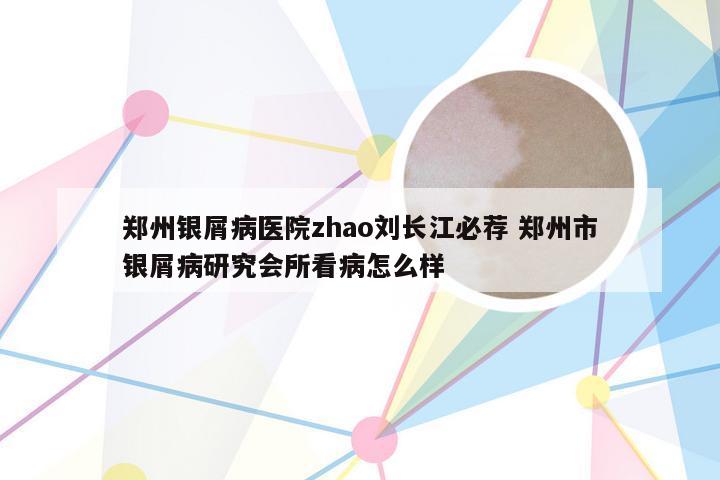 郑州银屑病医院zhao刘长江必荐 郑州市银屑病研究会所看病怎么样