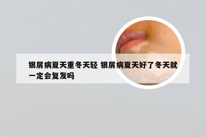 银屑病夏天重冬天轻 银屑病夏天好了冬天就一定会复发吗