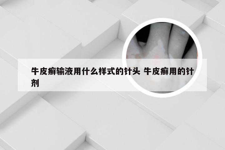 牛皮癣输液用什么样式的针头 牛皮癣用的针剂