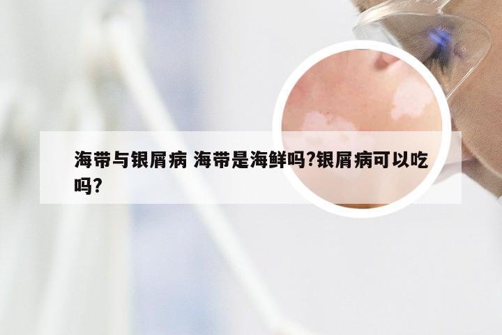 海带与银屑病 海带是海鲜吗?银屑病可以吃吗?