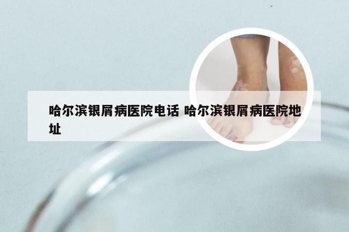哈尔滨银屑病医院电话 哈尔滨银屑病医院地址