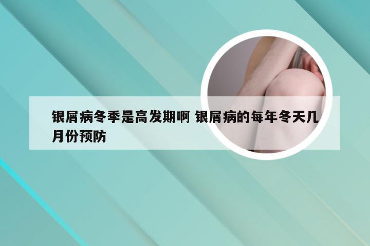 银屑病冬季是高发期啊 银屑病的每年冬天几月份预防