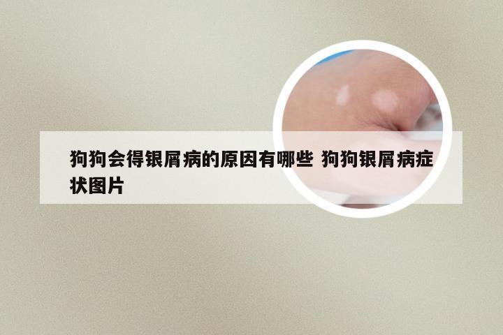 狗狗会得银屑病的原因有哪些 狗狗银屑病症状图片