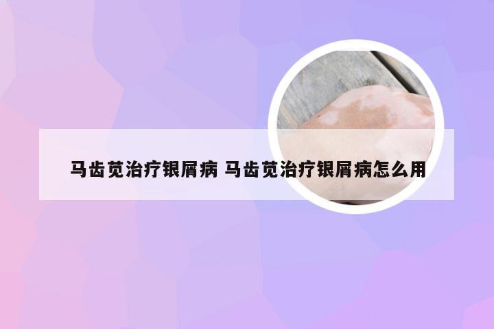 马齿苋治疗银屑病 马齿苋治疗银屑病怎么用