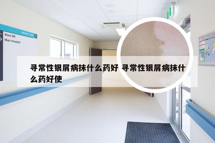寻常性银屑病抹什么药好 寻常性银屑病抹什么药好使