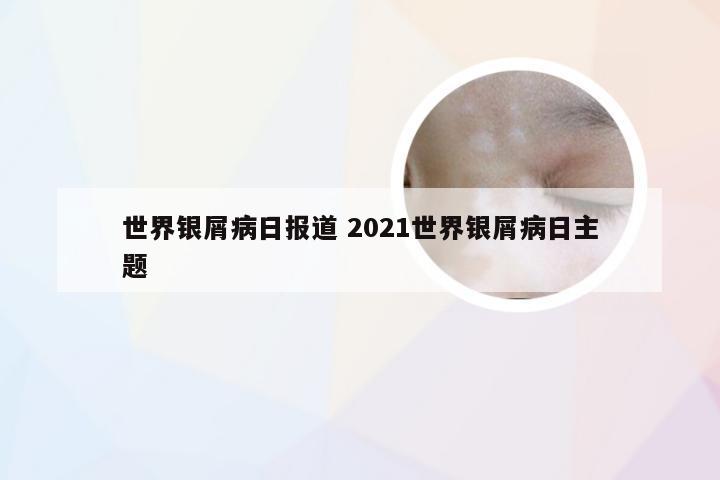 世界银屑病日报道 2021世界银屑病日主题