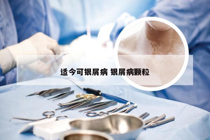 适今可银屑病 银屑病颗粒