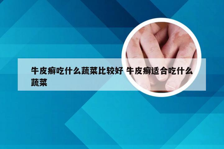 牛皮癣吃什么蔬菜比较好 牛皮癣适合吃什么蔬菜