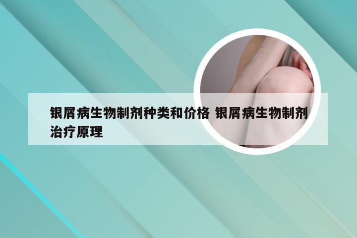银屑病生物制剂种类和价格 银屑病生物制剂治疗原理